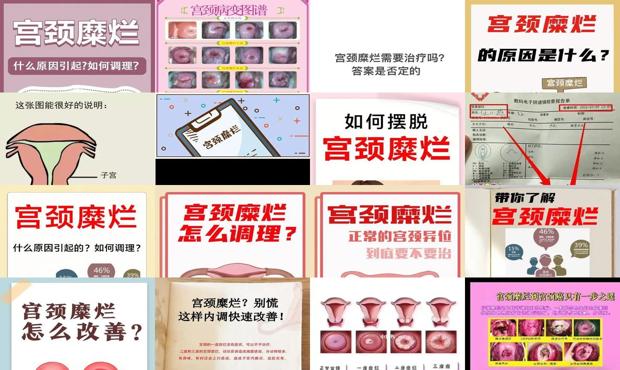 汕头宫颈糜烂是怎么引起的
