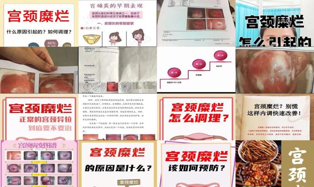 汕头宫颈糜烂怎么引起的