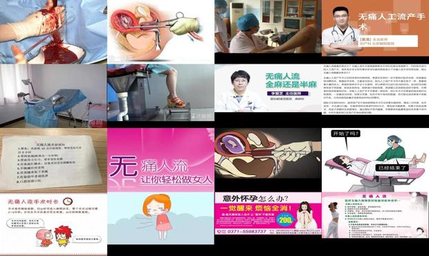 汕头*人流真的不痛吗