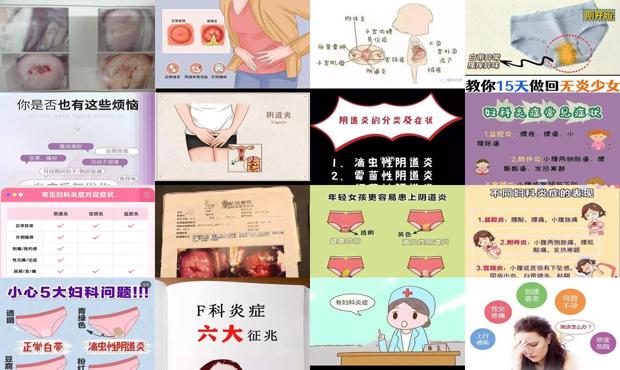 女性妇科炎用什么药治疗 - 汕头女性妇科炎症