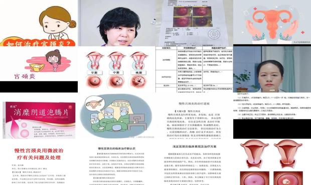 汕头宫颈炎怎么治疗