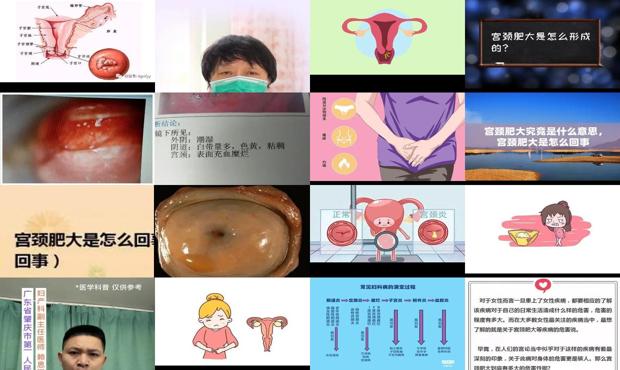 汕头宫颈肥大是怎么回事