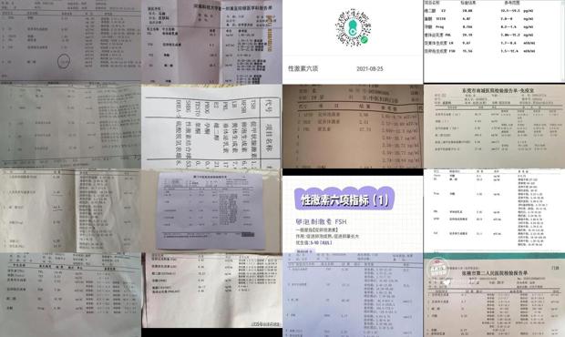 汕头性激素六项的检查