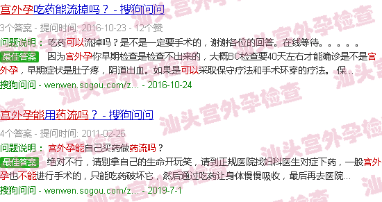 汕头宫外孕能药流吗