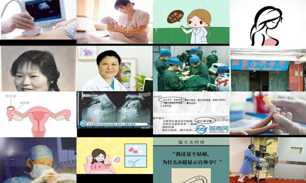 汕头怀孕多久可以做b超排除宫外孕
