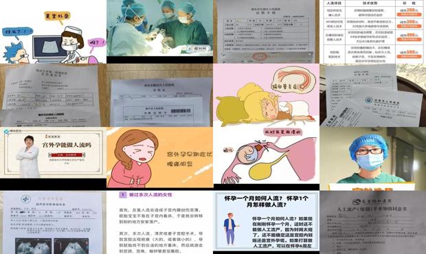 汕头宫外孕能做人流吗