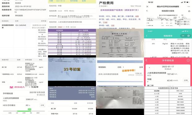 汕头hcg检查多少钱