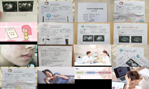 内分泌失调哪个医院比较好 - 汕头内分泌失调的检查