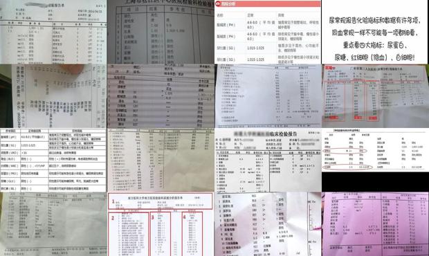 尿常规是检查多少钱 - 汕头尿常规主要检查什么