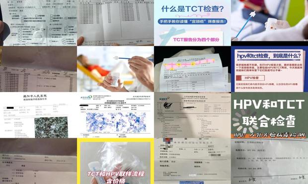 汕头tct检查