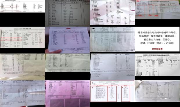 尿常规能不能检查 - 汕头尿常规能检查出什么