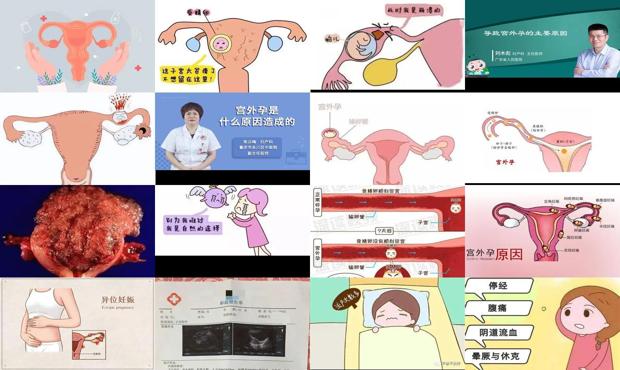 汕头引起宫外孕原因