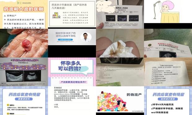 汕头怀孕10几天可以药流吗