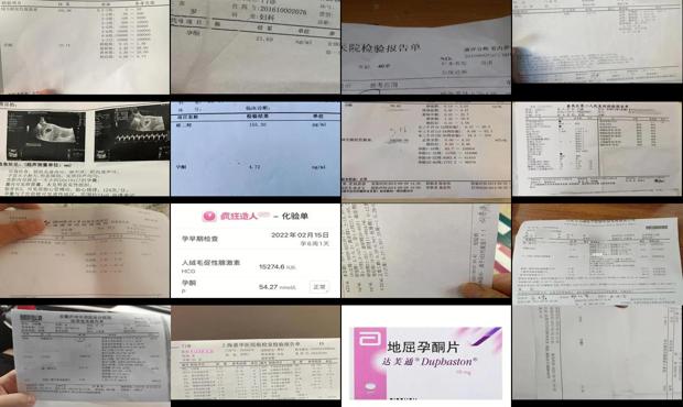汕头孕酮是检查什么的
