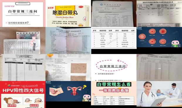汕头白带检查多少钱
