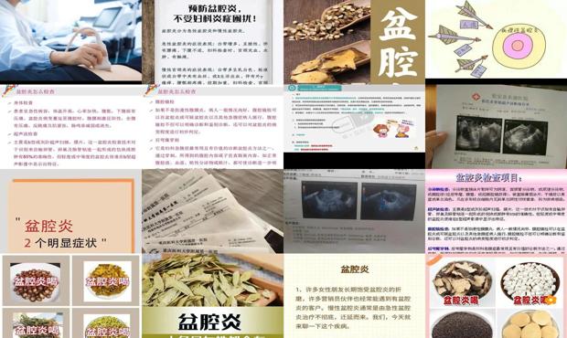 汕头盆腔炎怎么检查
