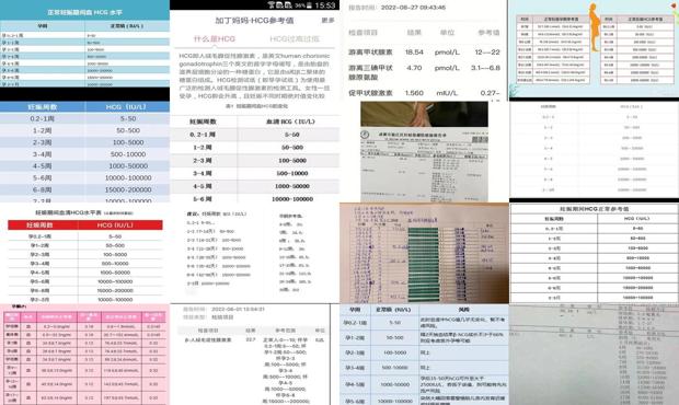 汕头宫外孕hcg参考值