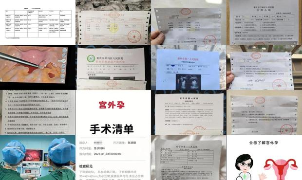 汕头宫外孕手术价格
