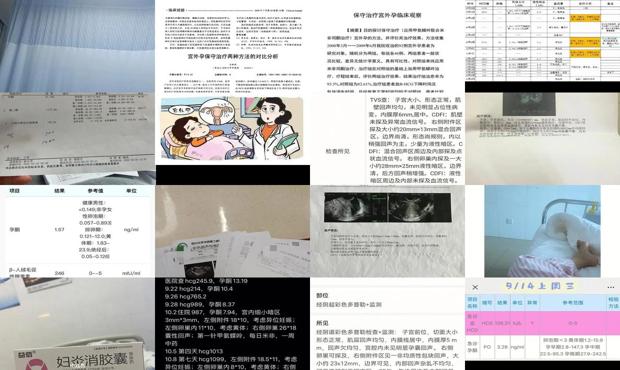 汕头宫外孕如何保守治疗