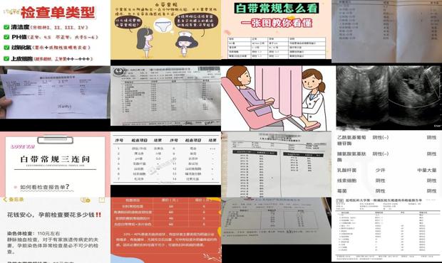 汕头白带常规检查多少钱