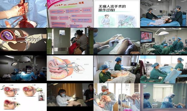 汕头*人流的过程