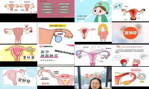汕头怎么避免宫外孕
