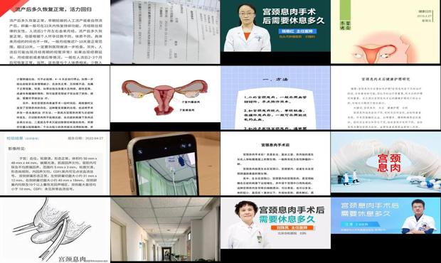 汕头宫颈息肉手术后需要休息多久