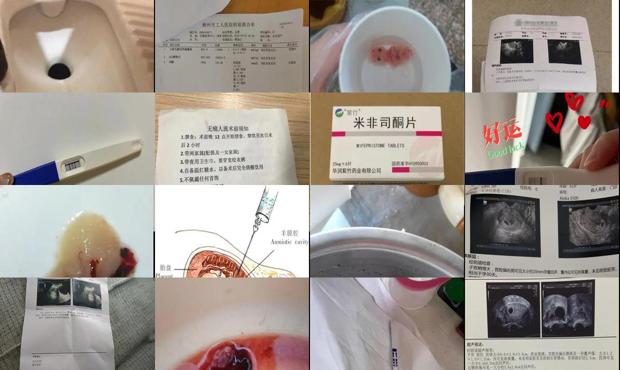 汕头早孕做药流