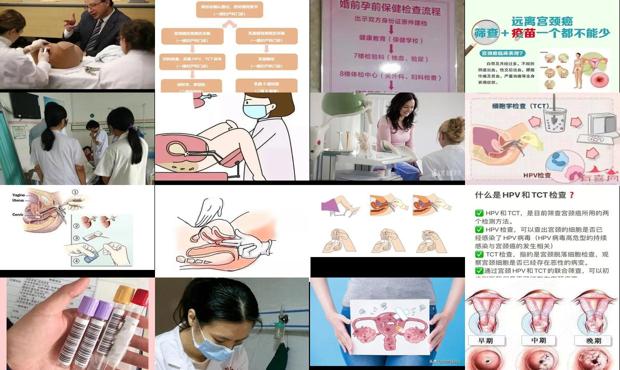 汕头宫颈检查怎么做