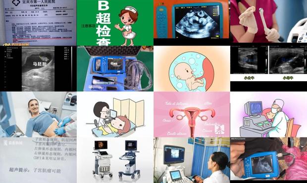 汕头b超检查子宫