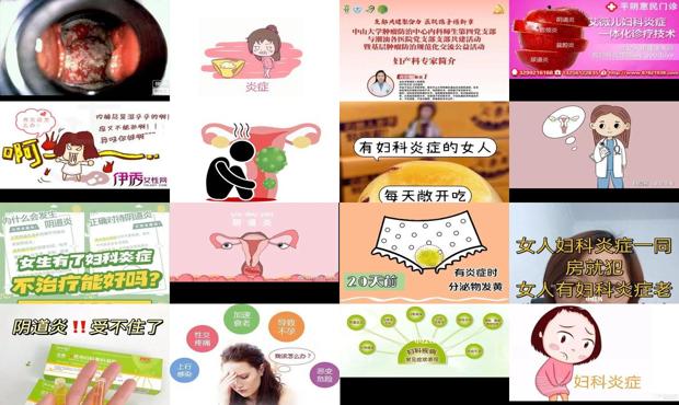 汕头女人妇科炎症