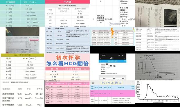 汕头宫外孕 hcg变化