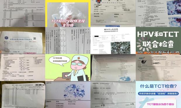 汕头tct检查是什么