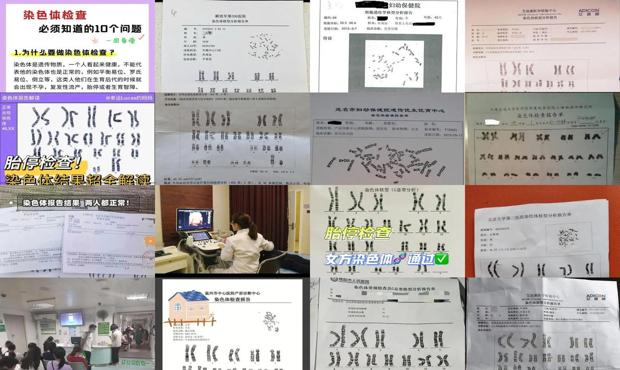 汕头染色体检查