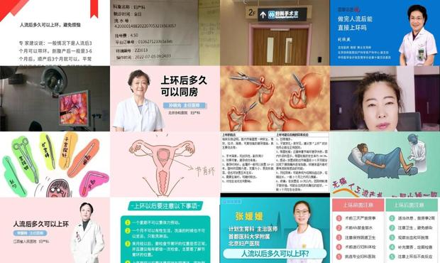 汕头*人流后多久可以上环
