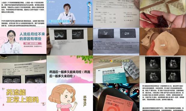 汕头药流之后多久来月经