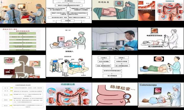 汕头肠镜检查过程示意图