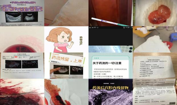 汕头药流后出血多久