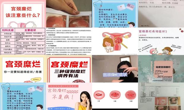 汕头怎么判断宫颈糜烂好了