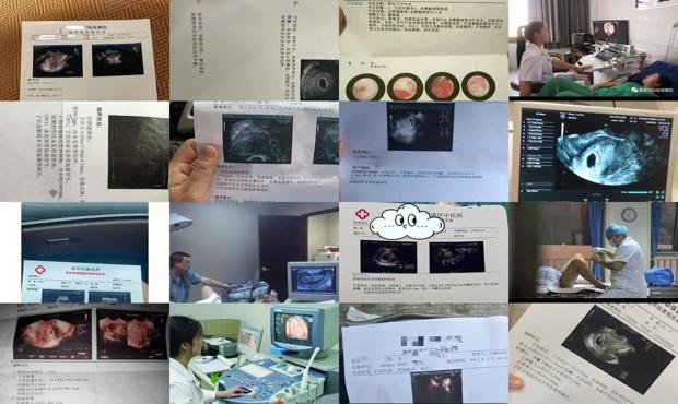 汕头阴超能检查出什么
