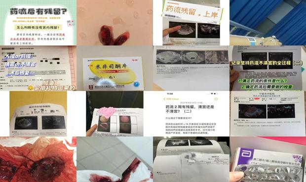 汕头药流后清宫