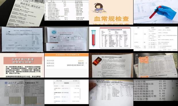 汕头血常规检查多少钱