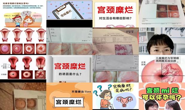 汕头宫颈糜烂会影响怀孕吗