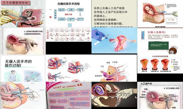 汕头*人流图解