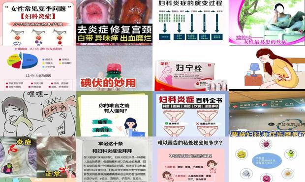汕头妇科炎症图片大*