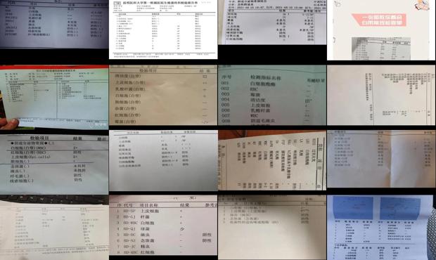 汕头白带常规检查结果怎么看