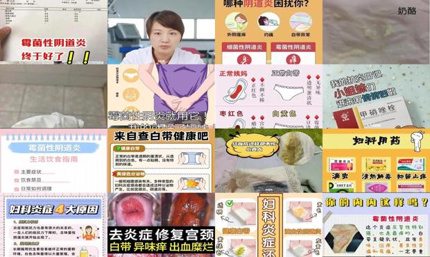 汕头霉菌性妇科炎症