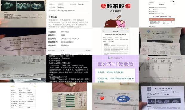 汕头查宫外孕*快的方法