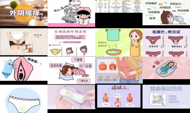 汕头妇科炎症引起外阴瘙痒