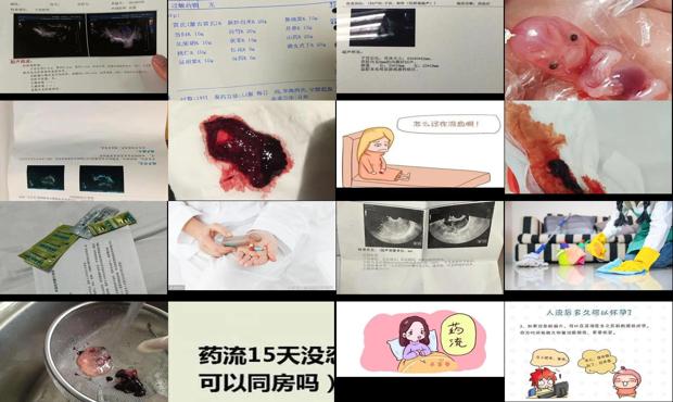 汕头药流后多久可以要孩子